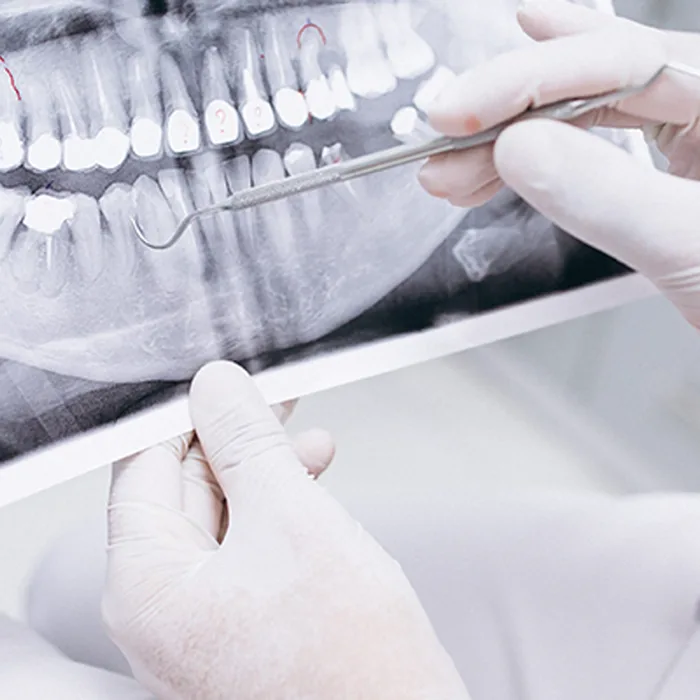 Oral Diagnoz ve Radyoloji