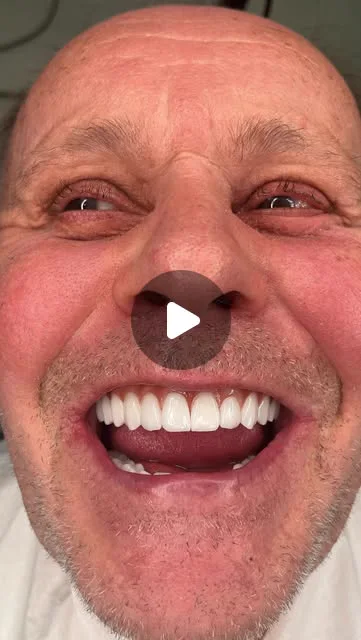 Instagram reel