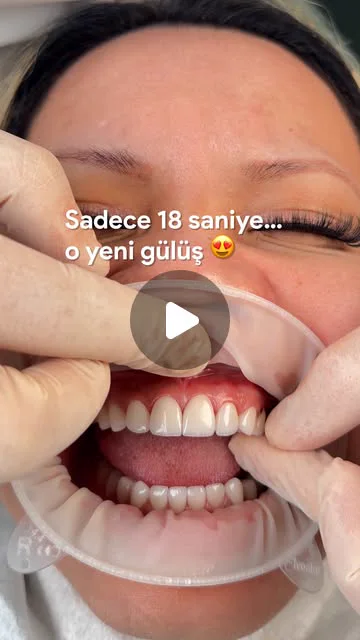 Instagram reel