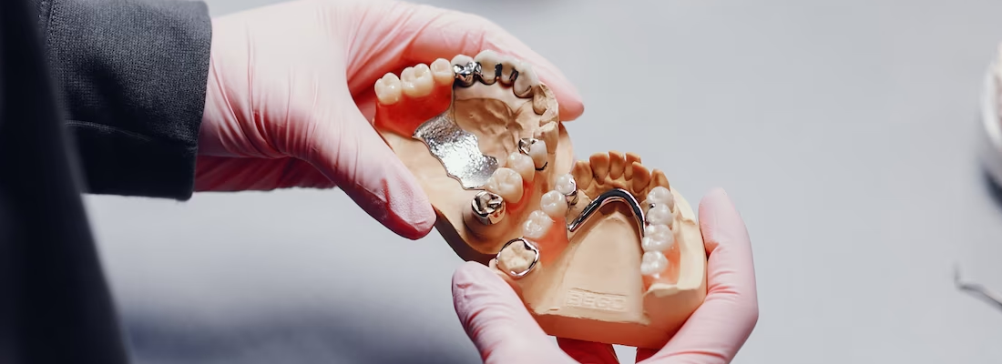 dental implant coast