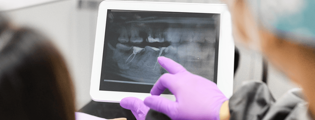 diş röntgeni