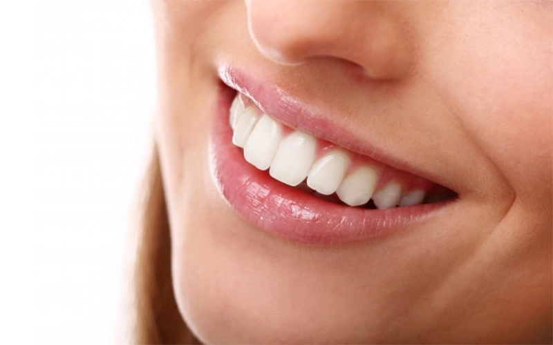 Hollywood Smile Nedir